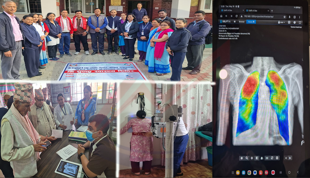 चन्द्रागिरिमा ‘सक्रिय क्षयरोग खोज पडताल कार्यक्रम’ सम्पन्न,भेटिए ३५ जना नयाँ क्षयरोग संक्रमित